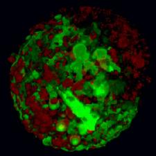 Cancer-fighting virus shown to target tumors alone