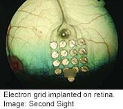 Device May Allow Blind to Read Braille Without Touch