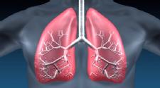 FDA approves first 2 drugs for idiopathic pulmonary fibrosis, a deadly lung disease
