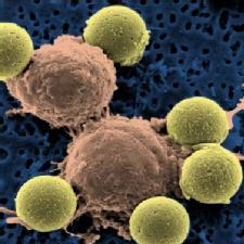 'Amazing' therapy wipes out leukemia in study