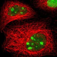 The Stress and Cancer Link: 'Master-Switch' Stress Gene Enables Cancer's Spread