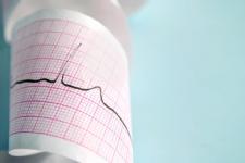 Shorter people have bigger risk of heart disease