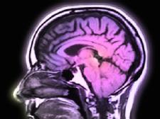 Speaking more than one language may help delay dementia