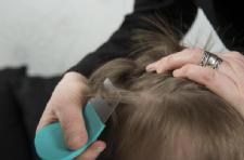 'Super lice' outbreak hits 25 states