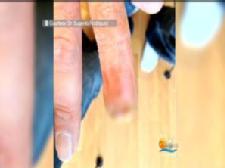 Doctor Uses New Technology To 